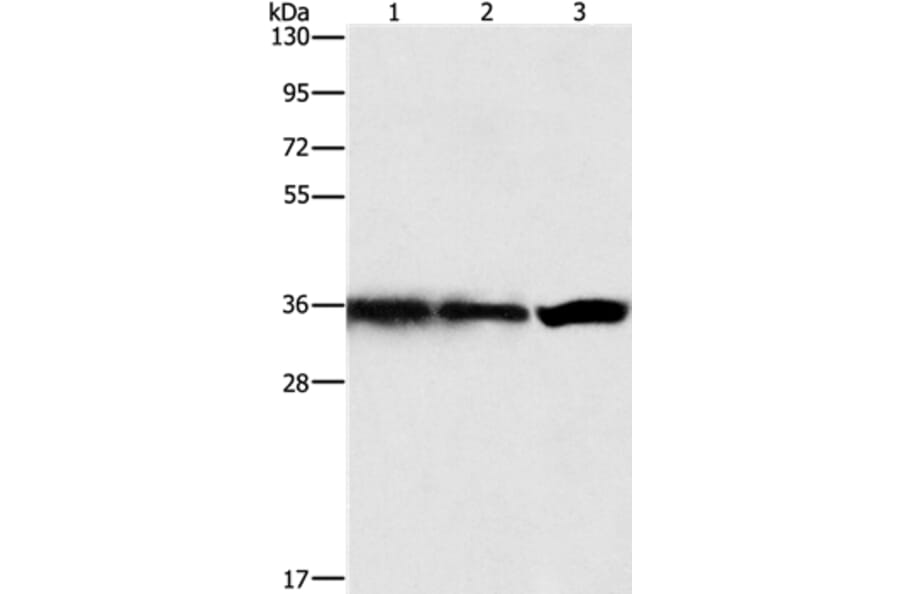 GNB1 Antibody from Signalway Antibody (35745) - Antibodies.com