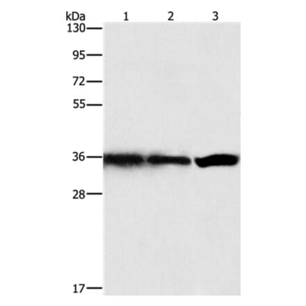 GNB1 Antibody from Signalway Antibody (35745) - Antibodies.com