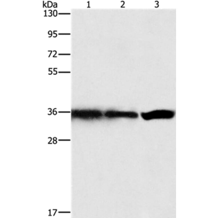 GNB1 Antibody from Signalway Antibody (35745) - Antibodies.com