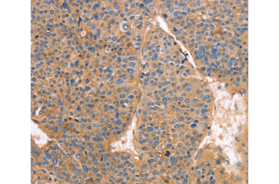 Immunohistochemistry - GNB1 Antibody from Signalway Antibody (35745) - Antibodies.com