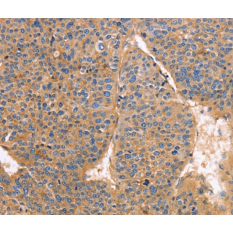 Immunohistochemistry - GNB1 Antibody from Signalway Antibody (35745) - Antibodies.com