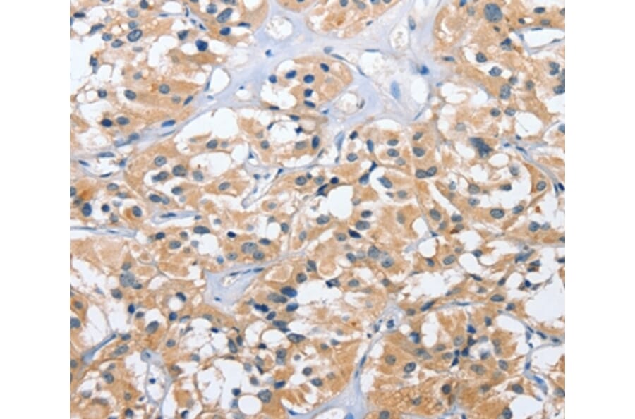 Immunohistochemistry - UGCG Antibody from Signalway Antibody (35753) - Antibodies.com