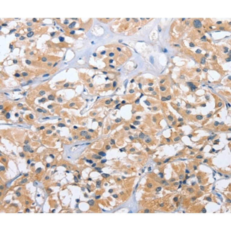 Immunohistochemistry - UGCG Antibody from Signalway Antibody (35753) - Antibodies.com