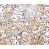 Immunohistochemistry - UGCG Antibody from Signalway Antibody (35753) - Antibodies.com