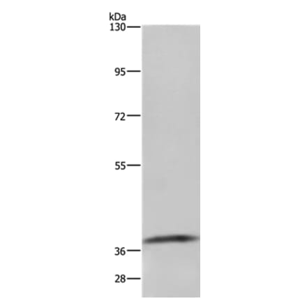 GDF3 Antibody from Signalway Antibody (35754) - Antibodies.com