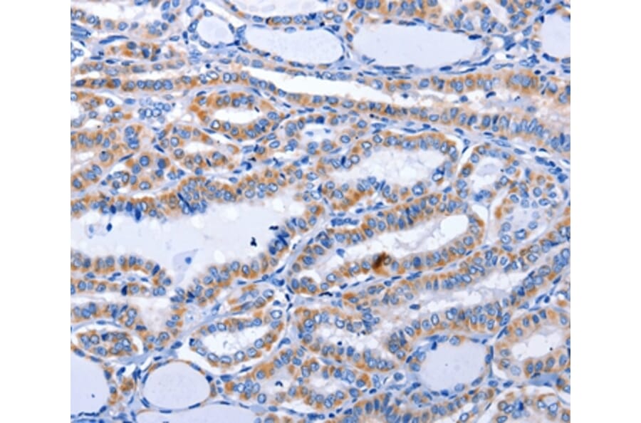Immunohistochemistry - GDF3 Antibody from Signalway Antibody (35754) - Antibodies.com