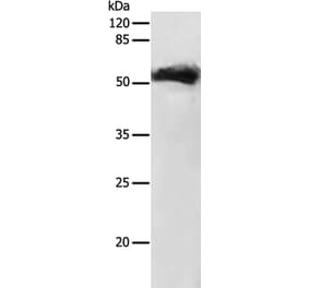 GDF9 Antibody from Signalway Antibody (35755) - Antibodies.com