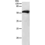 GDF9 Antibody from Signalway Antibody (35755) - Antibodies.com