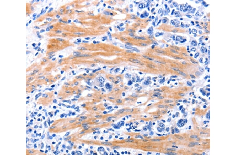 Immunohistochemistry - GDF9 Antibody from Signalway Antibody (35755) - Antibodies.com