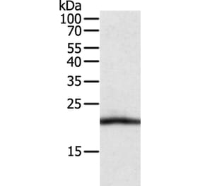 CSF2 Antibody from Signalway Antibody (35758) - Antibodies.com