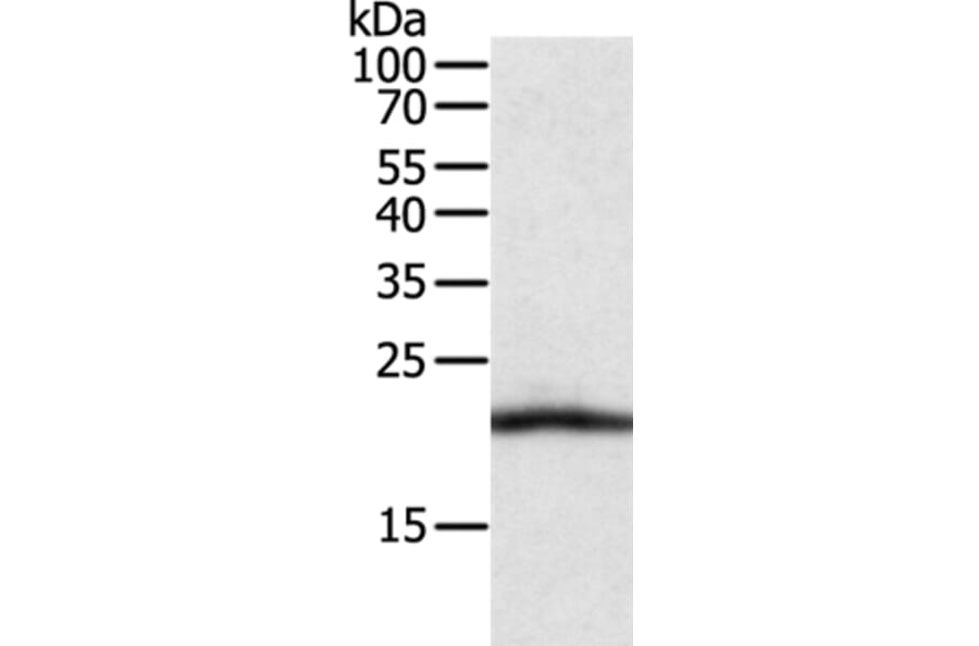 CSF2 Antibody from Signalway Antibody (35758) - Antibodies.com