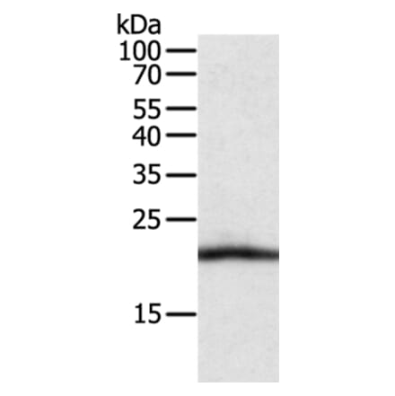 CSF2 Antibody from Signalway Antibody (35758) - Antibodies.com
