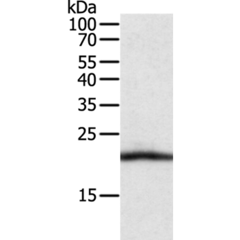 CSF2 Antibody from Signalway Antibody (35758) - Antibodies.com