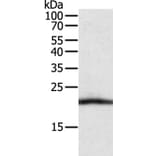 CSF2 Antibody from Signalway Antibody (35758) - Antibodies.com