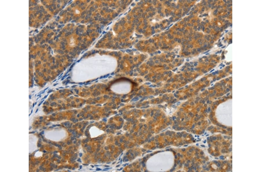 Immunohistochemistry - CSF2 Antibody from Signalway Antibody (35758) - Antibodies.com