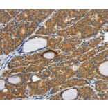 Immunohistochemistry - CSF2 Antibody from Signalway Antibody (35758) - Antibodies.com