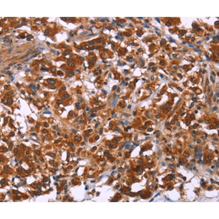 Immunohistochemistry - ING2 Antibody from Signalway Antibody (35779) - Antibodies.com