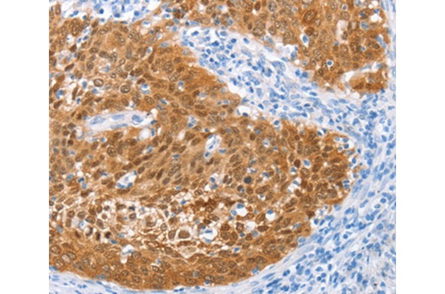 Immunohistochemistry - IRF6 Antibody from Signalway Antibody (35786) - Antibodies.com