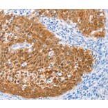 Immunohistochemistry - IRF6 Antibody from Signalway Antibody (35786) - Antibodies.com