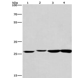 KLF7 Antibody from Signalway Antibody (35793) - Antibodies.com