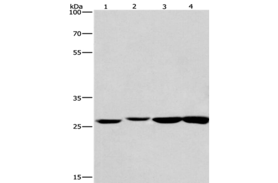 KLF7 Antibody from Signalway Antibody (35793) - Antibodies.com
