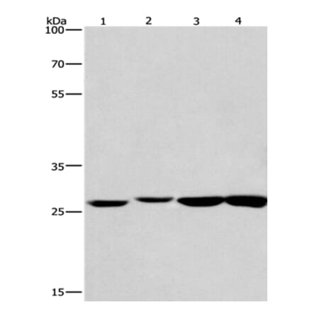 KLF7 Antibody from Signalway Antibody (35793) - Antibodies.com
