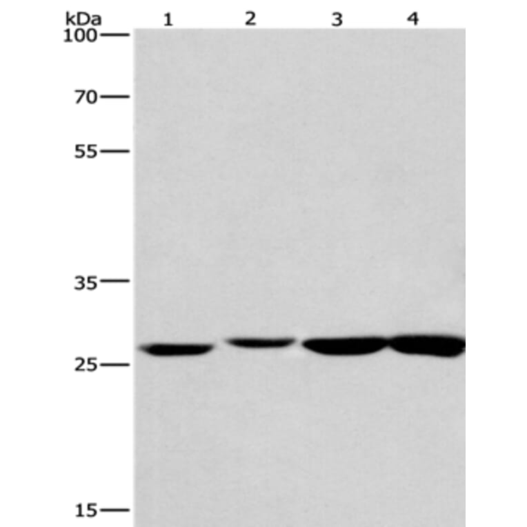KLF7 Antibody from Signalway Antibody (35793) - Antibodies.com