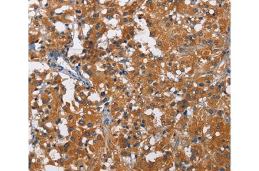 Immunohistochemistry - KLF7 Antibody from Signalway Antibody (35793) - Antibodies.com