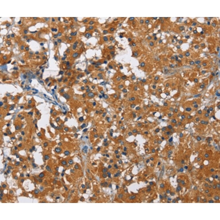 Immunohistochemistry - KLF7 Antibody from Signalway Antibody (35793) - Antibodies.com
