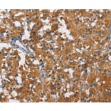Immunohistochemistry - KLF7 Antibody from Signalway Antibody (35793) - Antibodies.com