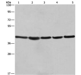RPSA Antibody from Signalway Antibody (35815) - Antibodies.com