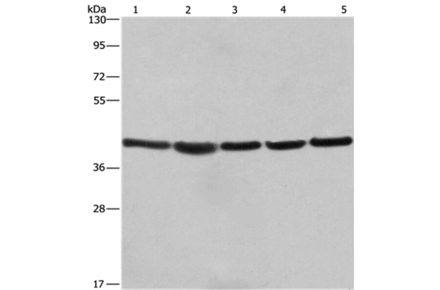 RPSA Antibody from Signalway Antibody (35815) - Antibodies.com
