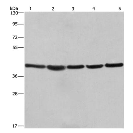 RPSA Antibody from Signalway Antibody (35815) - Antibodies.com