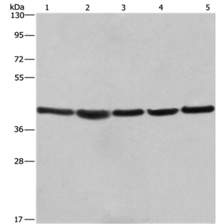RPSA Antibody from Signalway Antibody (35815) - Antibodies.com