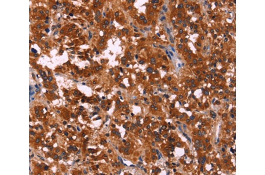 Immunohistochemistry - RPSA Antibody from Signalway Antibody (35815) - Antibodies.com