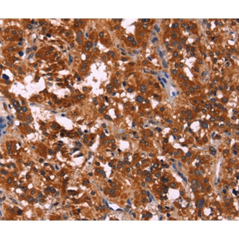 Immunohistochemistry - RPSA Antibody from Signalway Antibody (35815) - Antibodies.com