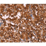 Immunohistochemistry - RPSA Antibody from Signalway Antibody (35815) - Antibodies.com