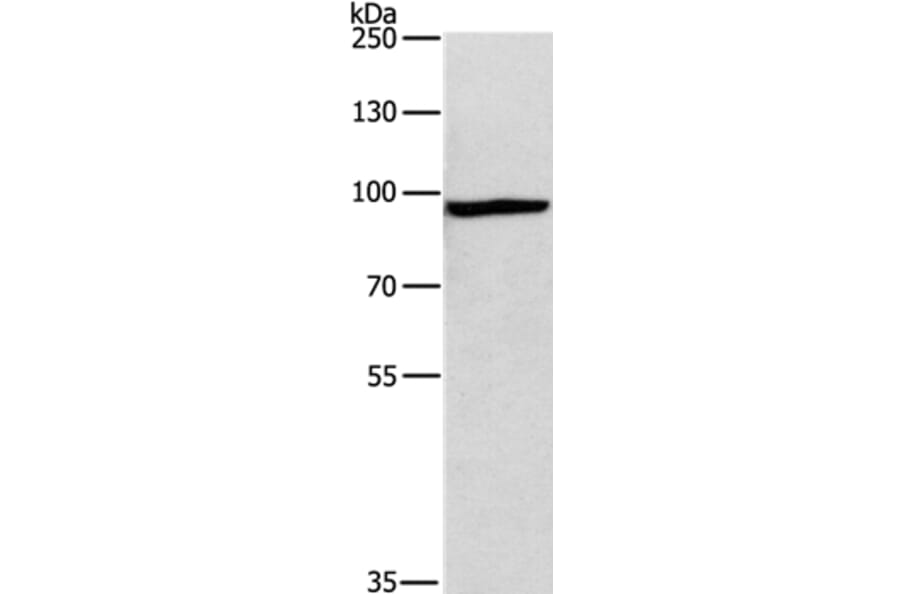 MSH5 Antibody from Signalway Antibody (35822) - Antibodies.com