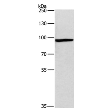 MSH5 Antibody from Signalway Antibody (35822) - Antibodies.com