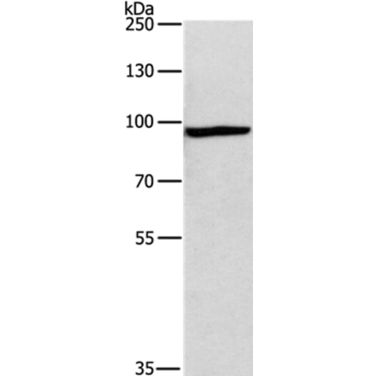 MSH5 Antibody from Signalway Antibody (35822) - Antibodies.com