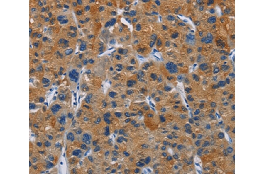 Immunohistochemistry - MSH5 Antibody from Signalway Antibody (35822) - Antibodies.com
