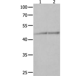 NCK1 Antibody from Signalway Antibody (35832) - Antibodies.com