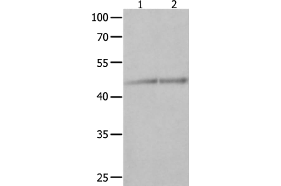 NCK1 Antibody from Signalway Antibody (35832) - Antibodies.com