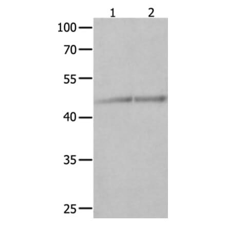 NCK1 Antibody from Signalway Antibody (35832) - Antibodies.com