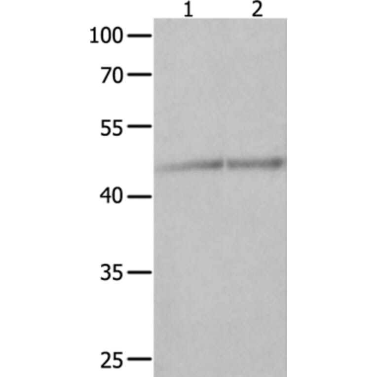 NCK1 Antibody from Signalway Antibody (35832) - Antibodies.com