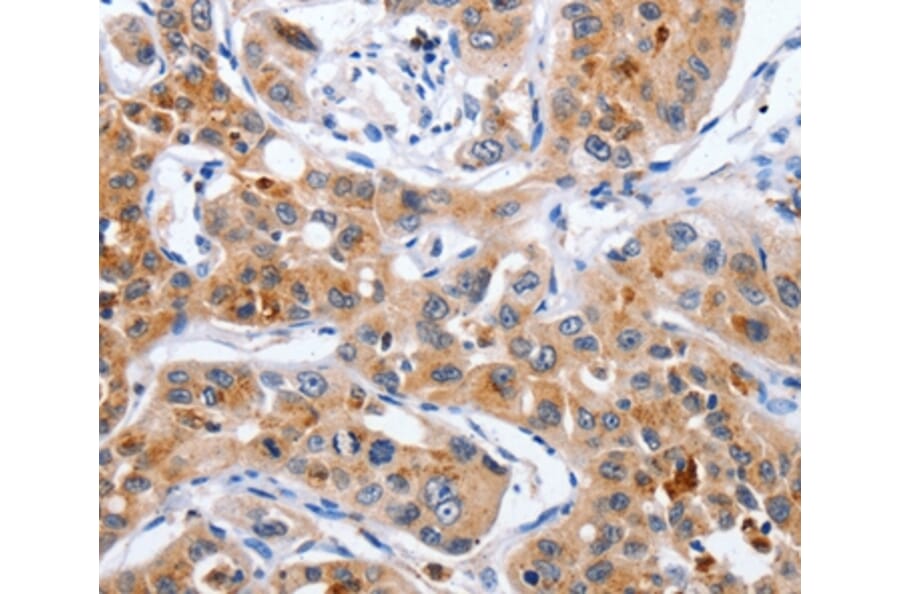 Immunohistochemistry - NCK1 Antibody from Signalway Antibody (35832) - Antibodies.com