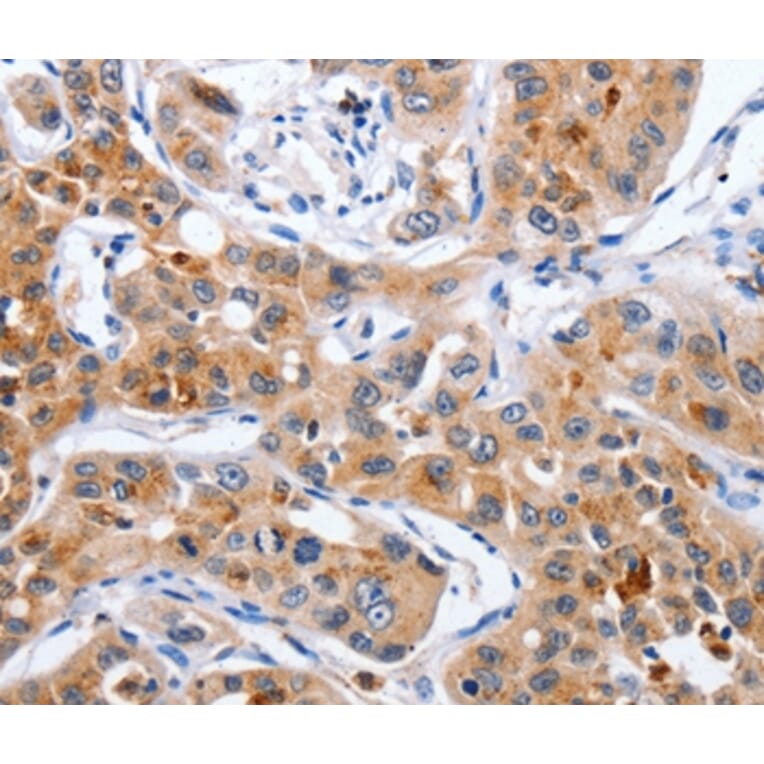 Immunohistochemistry - NCK1 Antibody from Signalway Antibody (35832) - Antibodies.com