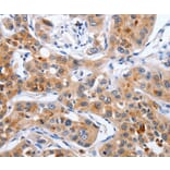 Immunohistochemistry - NCK1 Antibody from Signalway Antibody (35832) - Antibodies.com