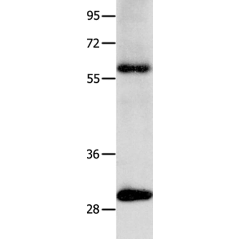 NTF3 Antibody from Signalway Antibody (35845) - Antibodies.com