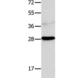 NTF4 Antibody from Signalway Antibody (35846) - Antibodies.com